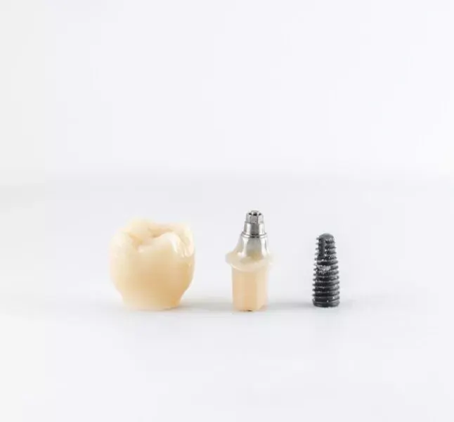 Corona, pilar e implante dental de titanio